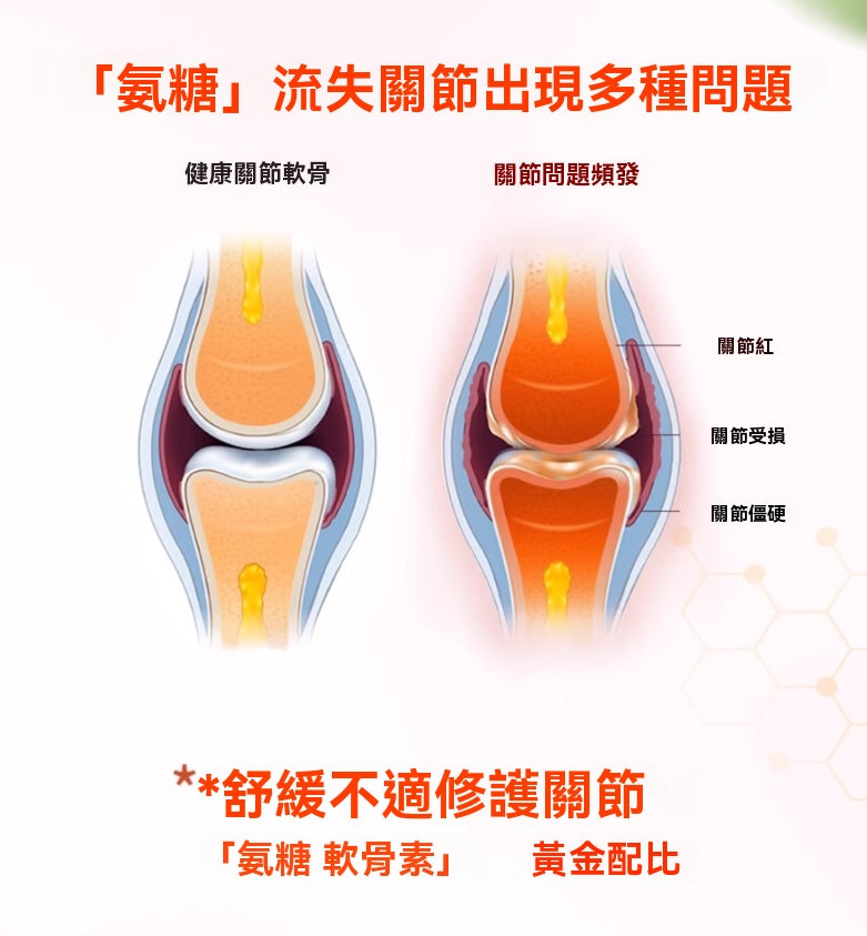 氨糖流失導致的關節軟骨受損、紅腫、僵硬問題示意圖。